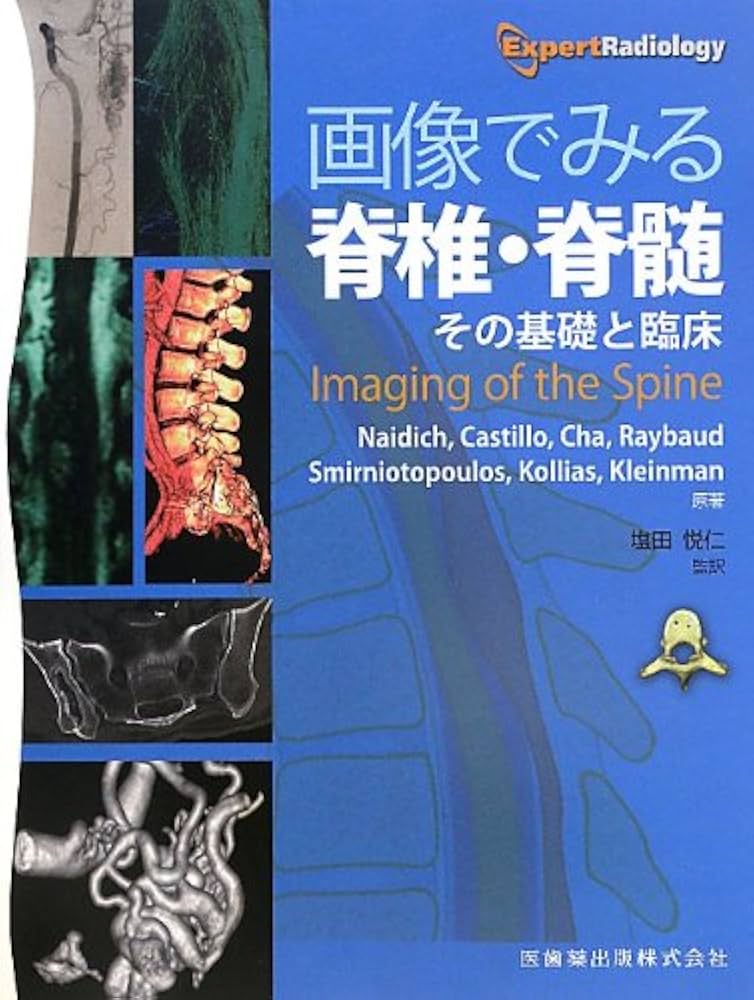 画像でみる脊椎・脊髄 その基礎と臨床 Imaging of the Spine 画像でみる脊椎・脊髄―その基礎と臨床 | Thomas P. Naidich ほか